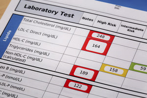 COVID19 Diagnostic Test- PCR