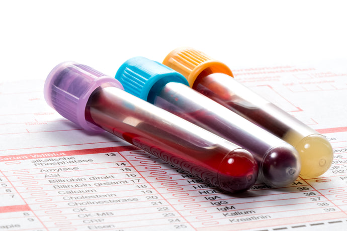 hCG Pregnancy Blood Test- Quantitative