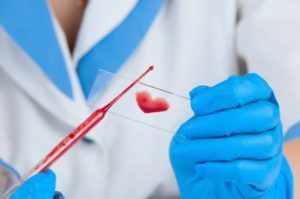hCG Pregnancy Blood Test- Qualitative