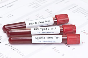 Prueba Completa de ETS (VIH 1 y 2, Herpes 1 y 2, Hepatitis B y C, Sífilis, Gonorrea/Clamidia)